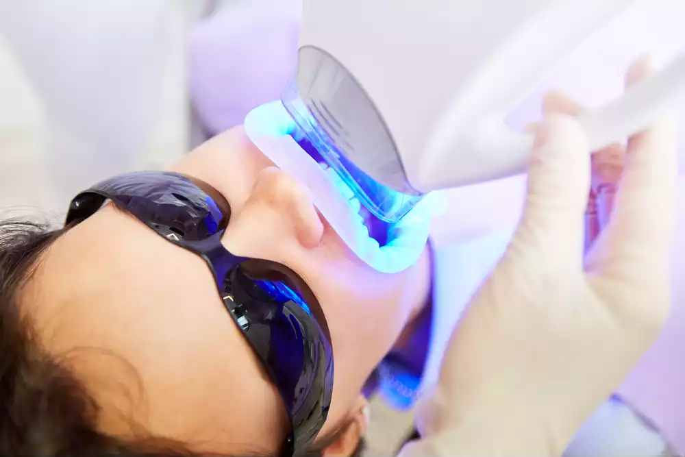 blanqueamiento dental en monterrey